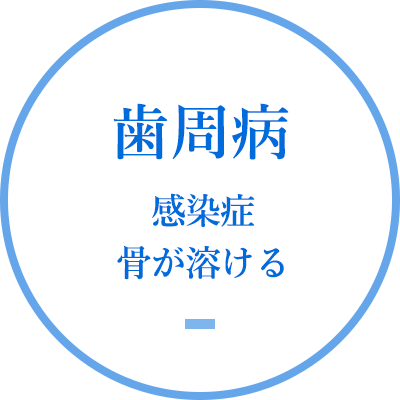 歯周病 感染症 骨が溶ける