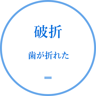 破折 歯が折れた